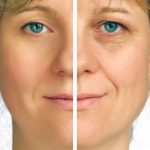 The lowdown on skin rejuvenation